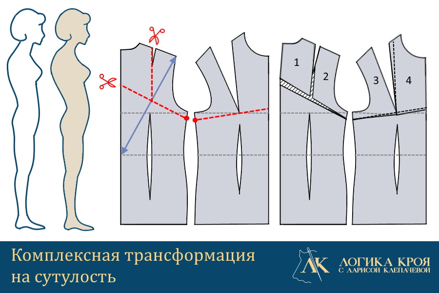 как изменить выкройку на сутулую фигуру