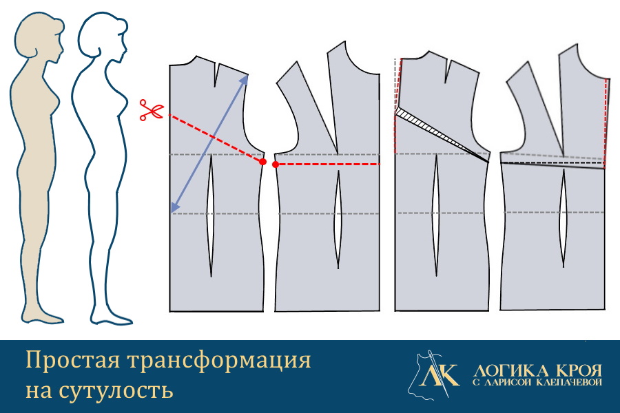 как изменить выкройку на сутулую фигуру